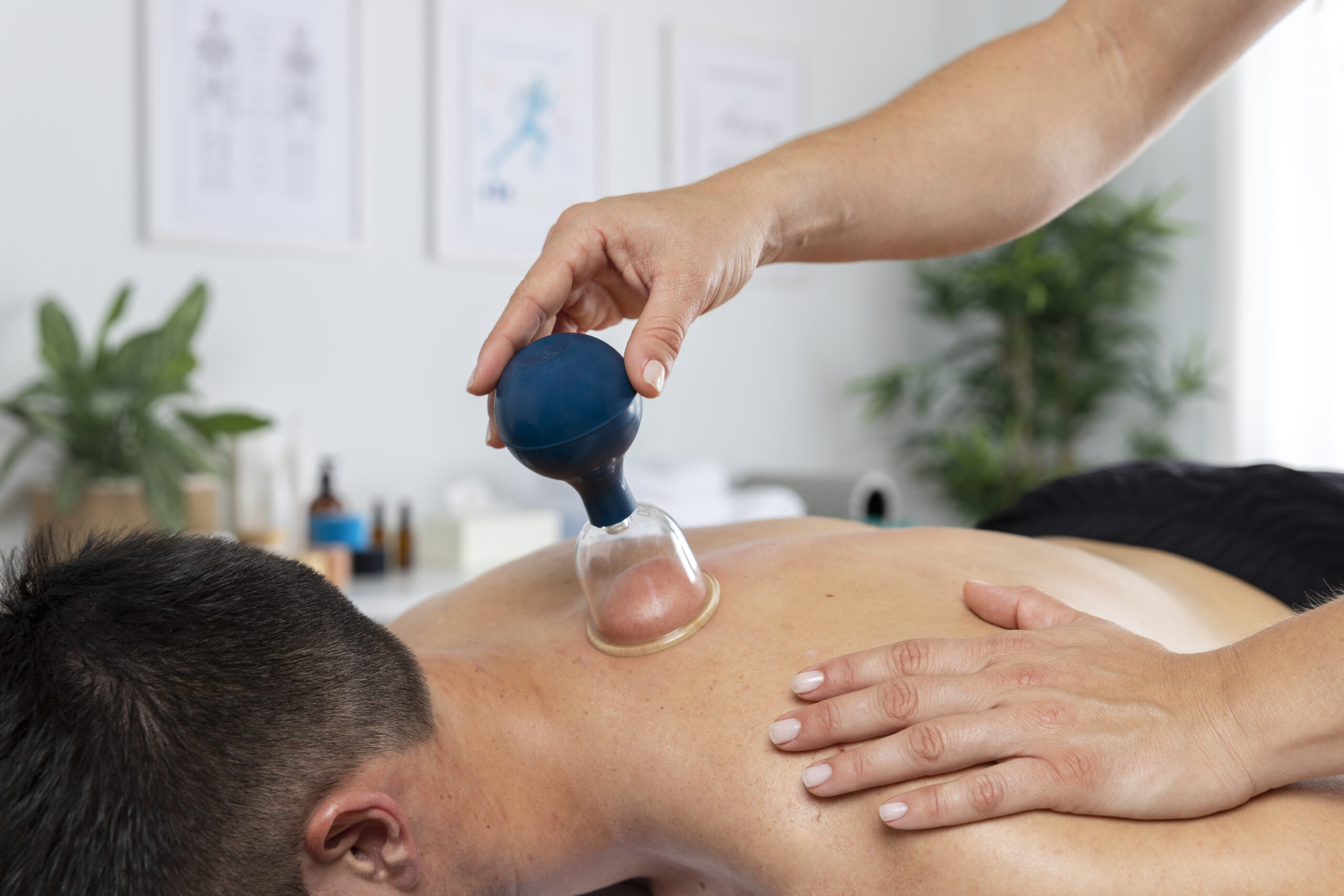 physiotherapist-performing-cupping-session-male-patient (1)